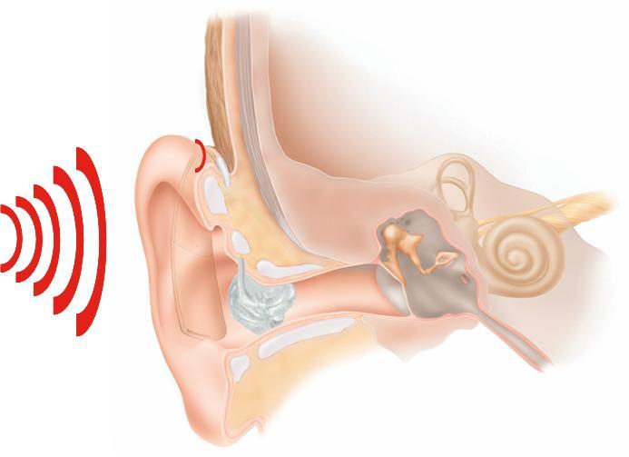 протезирование с помощью слухового аппарата